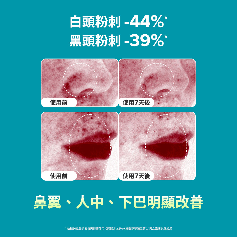 寶拉